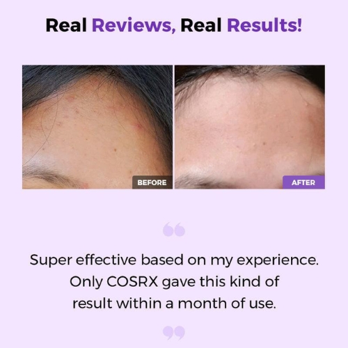 COSRX – AHA/BHA Clarifying Treatment Toner
