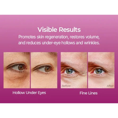 Dr.Melaxin Cemenrete Calcium Volume Multi Balm Resultaten