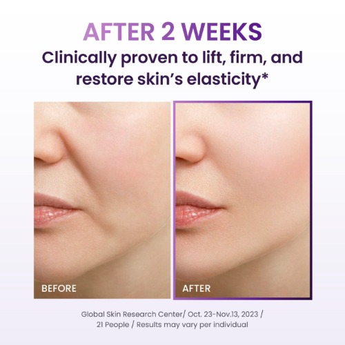 BIOHEAL BOH Probioderm 3D Lifting Cream-Resultaat 4