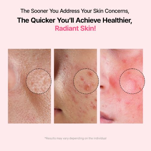 Veganifect Lifting & Balancing Fig Chestnut Pore Tight Ampoule-Resultaat 1