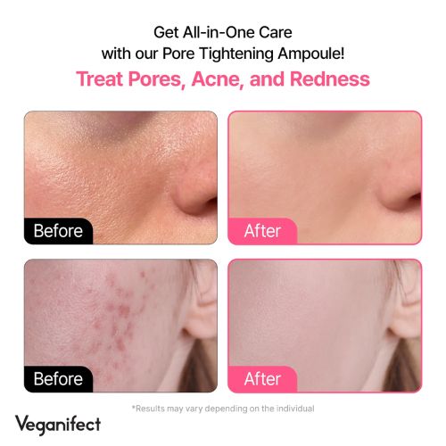 Veganifect Lifting & Balancing Fig Chestnut Pore Tight Ampoule-Resultaat 2