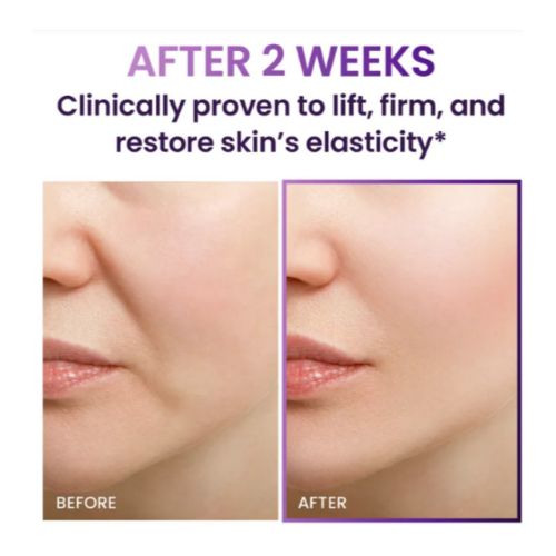 BIOHEAL BOH Probioderm 3D Lifting Skincare Set-Resultaat
