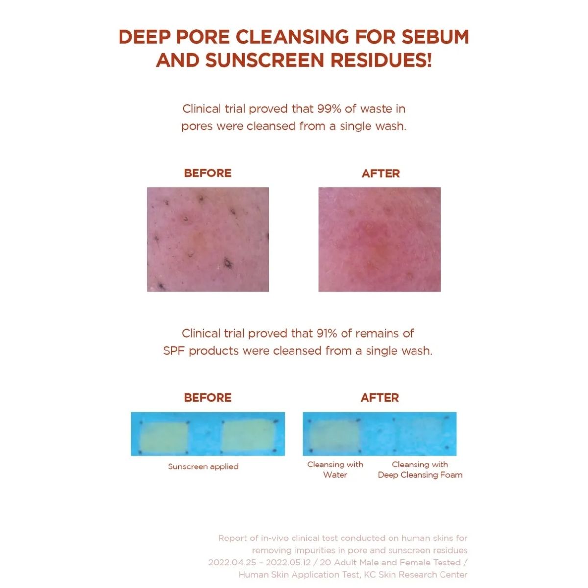 Infographic met klinische resultaten van de SKIN1004 Poremizing Deep Cleansing Foam.