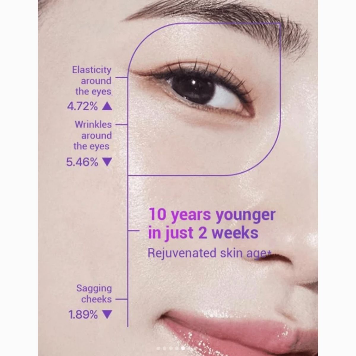 Resultaten voor elasticiteit en rimpels rond de ogen met BIOHEAL BOH Probioderm 3D Lifting Eye & Wrinkle Cream.