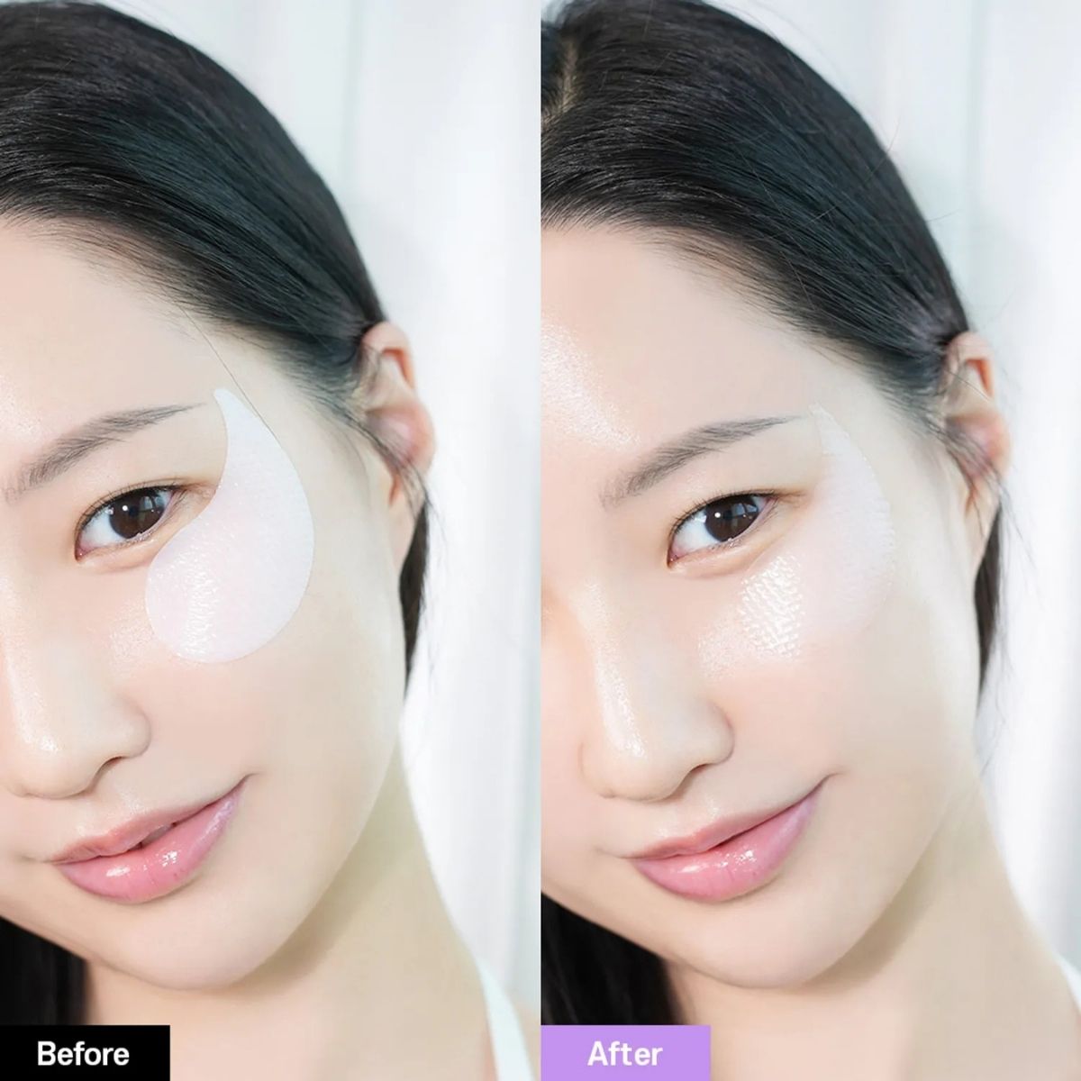 Voor- en nafoto van de BIOHEAL BOH Probioderm Collagen Remodeling Eye Patch onder het oog.