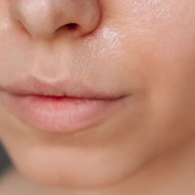 Beginnersroutine voor de vette huid – Zo start je met skincare